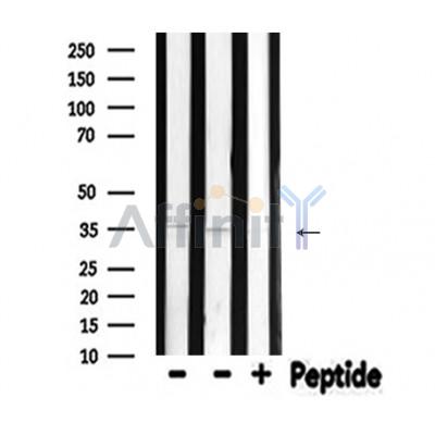 NEUROD1 Antibody - Western blot analysis of extracts from various samples, using NEUROD1 Antibody.