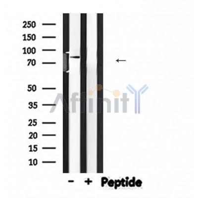 NEDD9 Antibody - Western blot analysis of NEDD9 expression in Rat brain lysates .