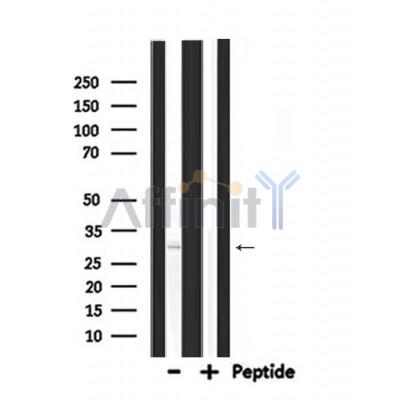 PDX1 Antibody - Western blot analysis of PDX1 expression in Mouse muscle lysates .