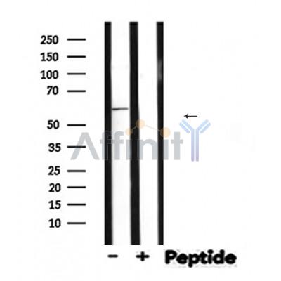 INA Antibody - Western blot analysis of INA expression in Mouse brain lysates .