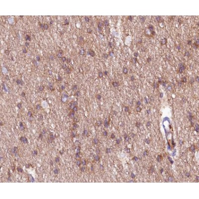 mGluR2/3 Antibody - AF0167 at 1/200 staining human brain tissue sections by IHC-P.