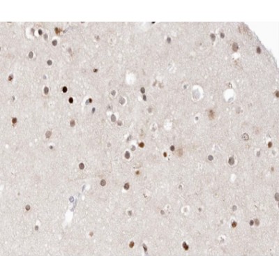 HDAC9 Antibody - AF0181 at 1/100 staining human brain tissue sections by IHC-P.