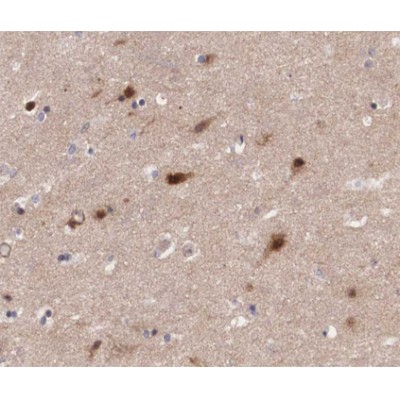 JM4 Antibody - AF0188 at 1/200 staining human brain tissue sections by IHC-P.