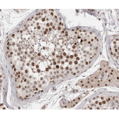 Phospho-SRF (Ser99)[Ser103] Antibody - AF3160 at 1/200 staining human testis tissue sections by IHC-P.