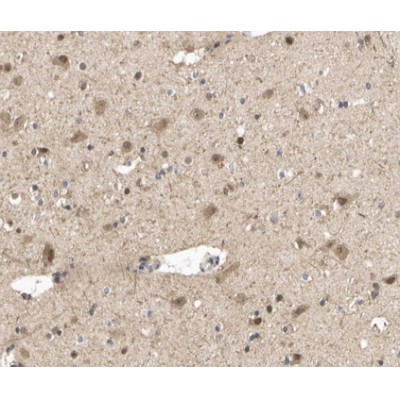 Phospho-STAT5A (Ser780) Antibody - AF3303 at 1/200 staining human brain tissue sections by IHC-P.