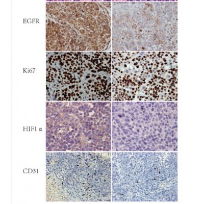 EGFR Antibody - Histological and immunohistochemistry analysis.