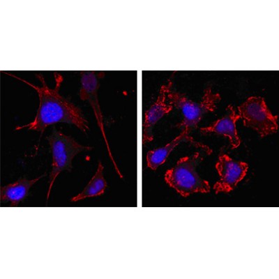 beta-Actin Antibody -  Confocal immunofluorescence analysis of SKBR-3 (left) and A549 (right) cells using beta Actin mouse mAb (red, the secondary Ab is Cy3-Goat anti mouse IgG).