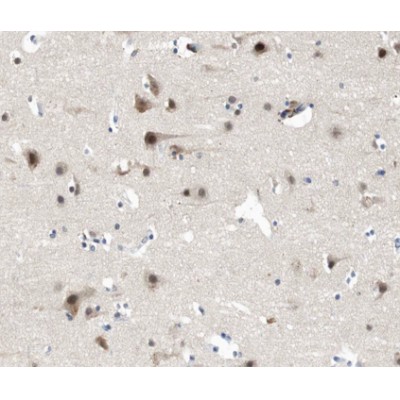 PSD95 Antibody - AF5283 at 1/200 staining human brain tissue sections by IHC-P.
