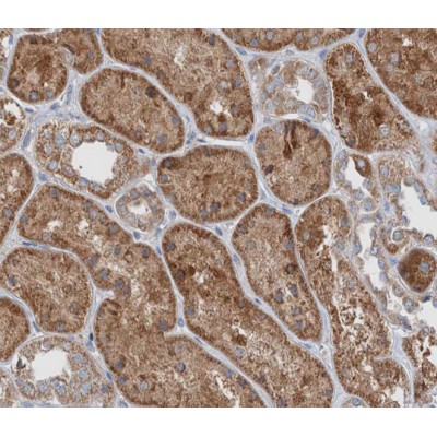 Catenin gamma Antibody - AF0124 at 1/200 staining human kidney tissue sections by IHC-P.