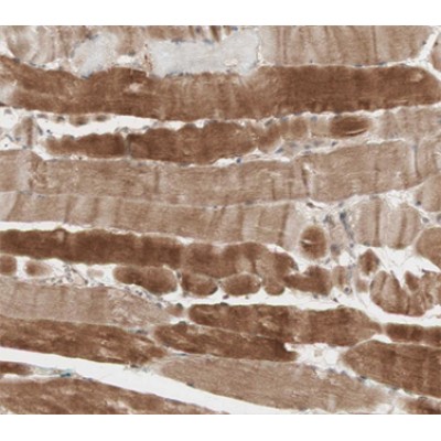 Desmin Antibody - AF0147 at 1/200 staining human skeletal muscle tissue sections by IHC-P.
