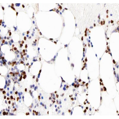 MMP8 Antibody - AF0219 at 1/100 staining human bone tissue sections by IHC-P.