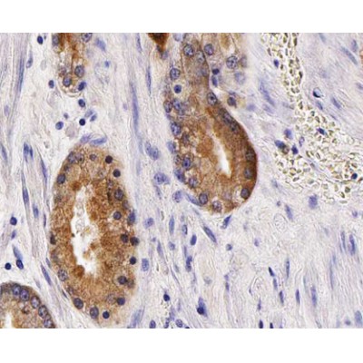 TM16G Antibody - AF0648 at 1/100 staining human Prostate tissue sections by IHC-P.