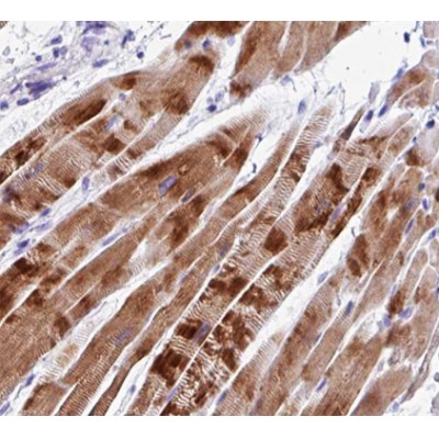ECRG4 Antibody - AF0475 at 1/100 staining human Skeletal muscle tissue sections by IHC-P.