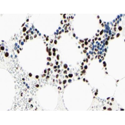 IRAK3 Antibody - AF0690 at 1/100 staining human Bone marrow tissue sections by IHC-P.