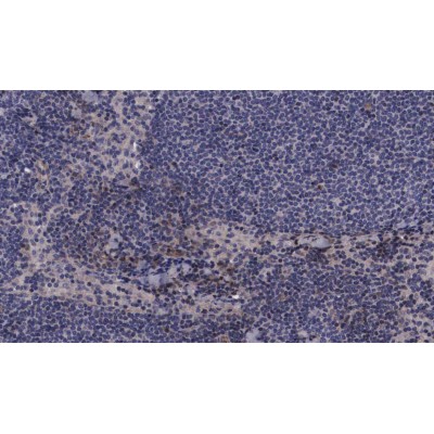 Phospho-MKK3 (Ser189) Antibody - AF3327 at 1/100 staining human lymph node tissue sections by IHC-P.