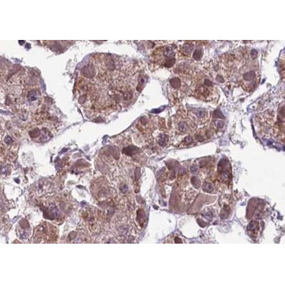Phospho-MEK1/2 (Ser217/221)[Ser218/222] Antibody - AF3384 at 1/100 staining human liver tissue sections by IHC-P.