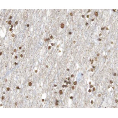Retinoic Acid Receptor beta Antibody - AF0249 at 1/100 staining human brain tissue sections by IHC-P.