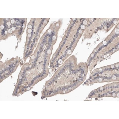 PDLIM1 Antibody - AF0303 at 1/100 staining human colon tissue sections by IHC-P.