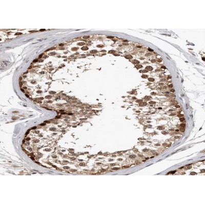 PPP1R2 Antibody - AF0799 at 1/100 staining human testis tissue sections by IHC-P.