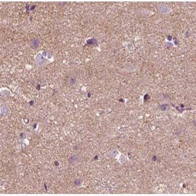 Rabphilin 3A Antibody - AF0777 at 1/100 staining human Brain tissue sections by IHC-P.