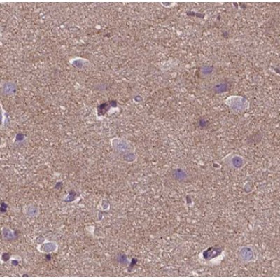 ACTG2 Antibody - AF0520 at 1/100 staining human brain tissue sections by IHC-P.