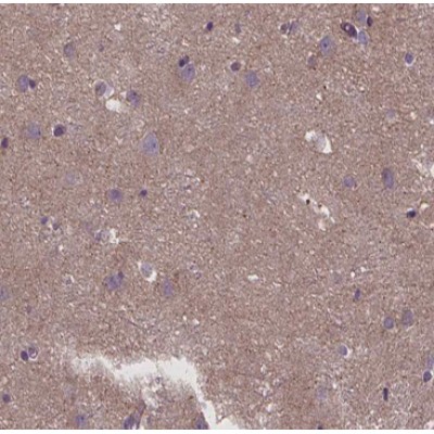 Fibronectin Antibody - AF0738 at 1/100 staining human brain tissue sections by IHC-P.