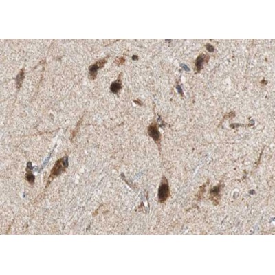 GAD1/2 Antibody - AF0711 at 1/100 staining human brain tissue sections by IHC-P.