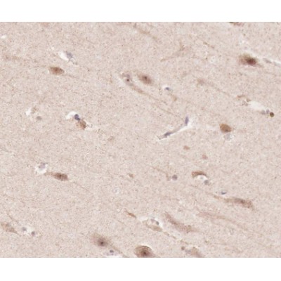 TNF Receptor I Antibody - AF0282 at 1/100 staining human brain tissue sections by IHC-P.