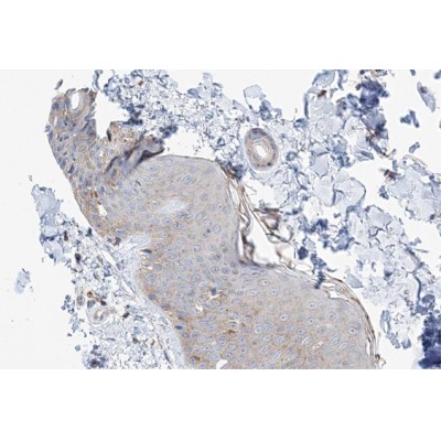 MAST4 Antibody - AF0731 at 1/100 staining human skin tissue sections by IHC-P.