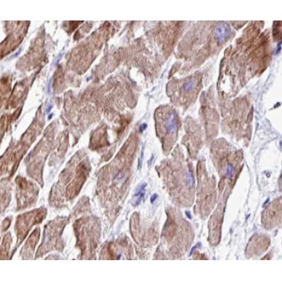 TRIM3 Antibody - AF0453 at 1/100 staining human heart muscle tissue sections by IHC-P.