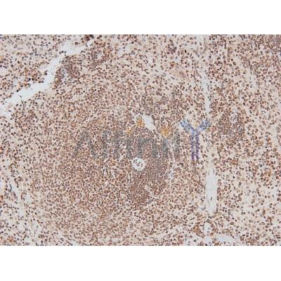 Phospho-IRAK1 (Thr387) Antibody - AF8009 at 1/200 staining Rat spleen tissue sections by IHC-P.