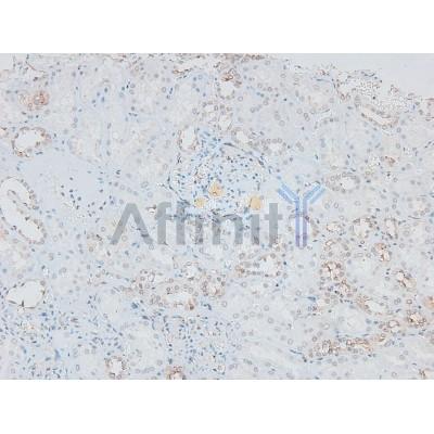 Phospho-IRAK1 (Thr387) Antibody - AF8009 at 1/200 staining Human kidney tissue sections by IHC-P.