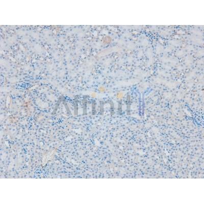 Phospho-PKC beta 1 (Ser661) Antibody - AF8028 at 1/200 staining Mouse kidney tissue sections by IHC-P.