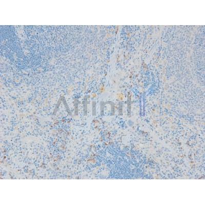 Phospho-CFTR (Ser737) Antibody - AF8042 at 1/200 staining Rat spleen tissue sections by IHC-P.