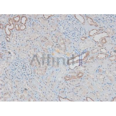 Phospho-ILK (Ser343) Antibody - AF8070 at 1/200 staining Human kidney tissue sections by IHC-P.