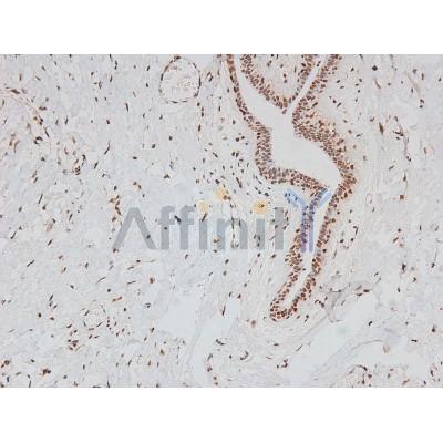 Phospho-FER (Tyr714) Antibody - AF8147 at 1/200 staining Human breast tissue sections by IHC-P.
