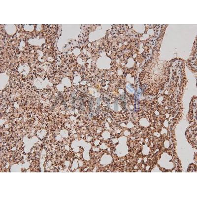 Phospho-FER (Tyr714) Antibody - AF8147 at 1/200 staining Mouse lung tissue sections by IHC-P.