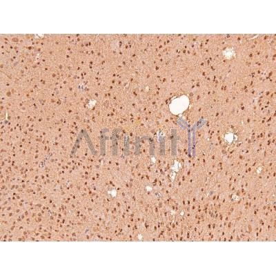 Phospho-IFNAR1 (Ser535) Antibody - AF8229 at 1/200 staining Mouse brain tissue sections by IHC-P.