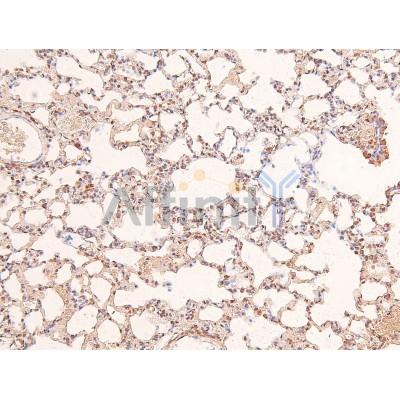 Phospho-IFNAR1 (Ser535) Antibody - AF8229 at 1/200 staining Rat kidney tissue sections by IHC-P.