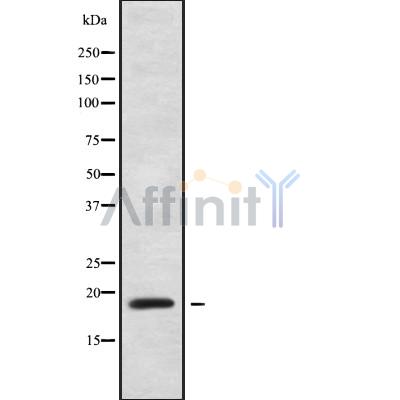 CNBP Antibody - Western blot analysis of CNBP using 293 whole cell lysates.