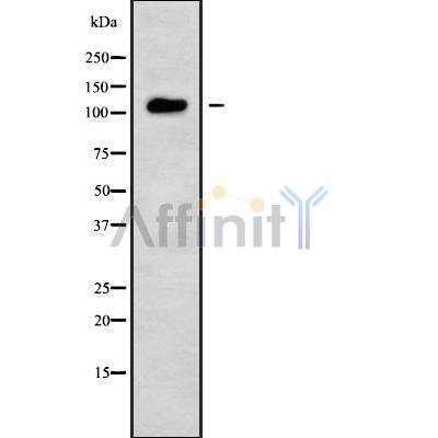 TSH3 Antibody - Western blot analysis of TSH3 using COLO205 whole cell lysates.