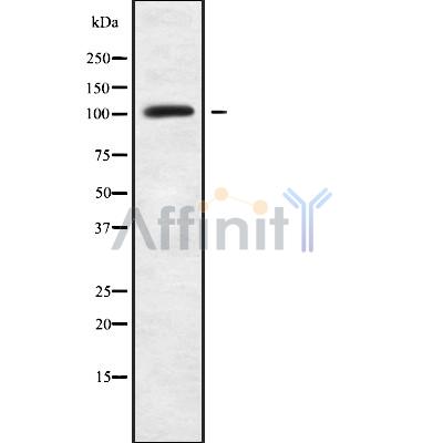 LARP2 Antibody - Western blot analysis of LARP2 using HUVEC whole cell lysates.