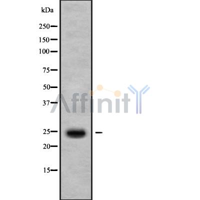 IL1F7 Antibody - Western blot analysis IL1F7 using HepG2 whole cell lysates.
