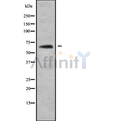 KRT84 Antibody - Western blot analysis of KRT84 using HeLa whole cell lysates.