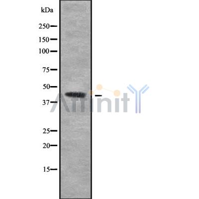 KLF17 Antibody - Western blot analysis of KLF17 using HeLa whole cell lysates.