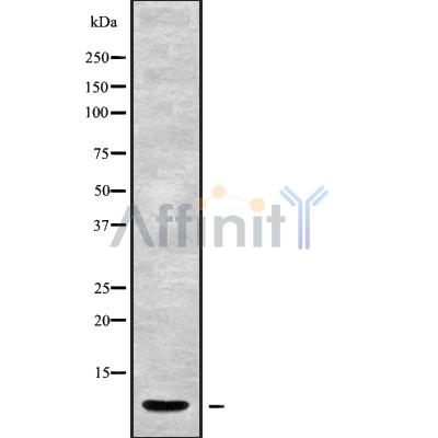 Truncated steroid 21-hydroxylase Antibody - Western blot analysis of Truncated steroid 21-hydroxylase using 293 whole cell lysates.