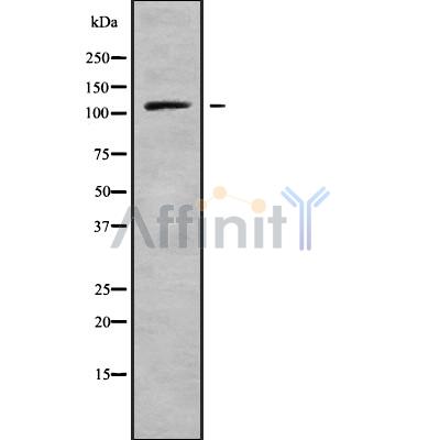 PSD4 Antibody - Western blot analysis of PSD4 using HT-29 whole cell lysates.