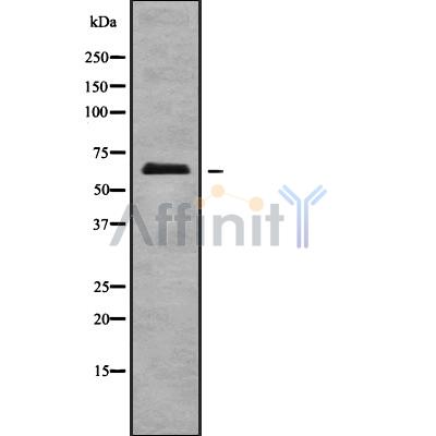 ECM1 Antibody - Western blot analysis of ECM1 using HUVEC whole cell lysates.