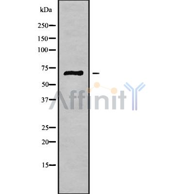 PODN Antibody - Western blot analysis of PODN using K562 whole cell lysates.