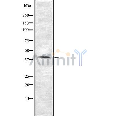 VN1R1 Antibody - Western blot analysis of VN1R1 using HUVEC whole cell lysates.